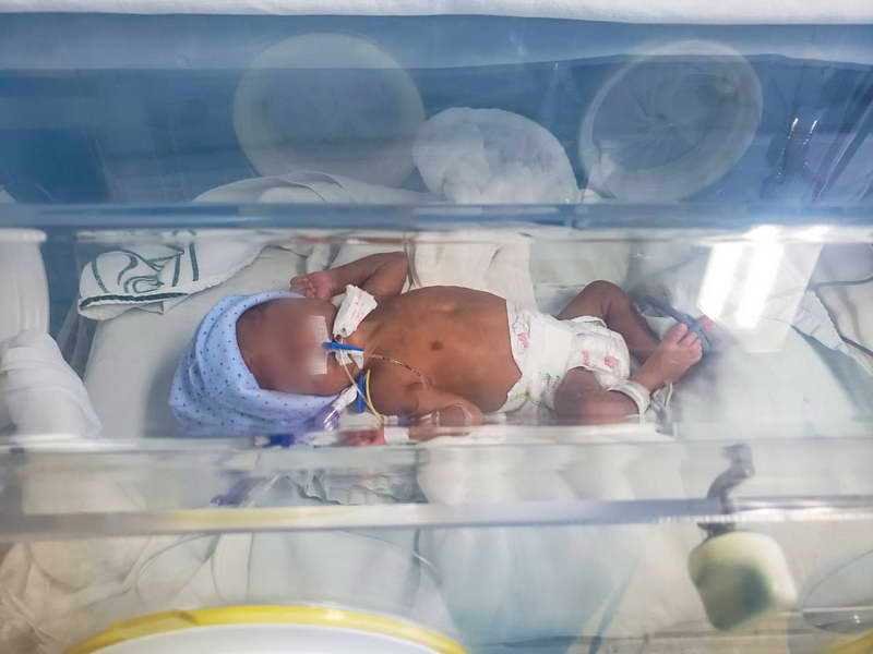 Nacieron cuatrillizos en HGZ 8 del IMSS Córdoba en medio de la emergencia