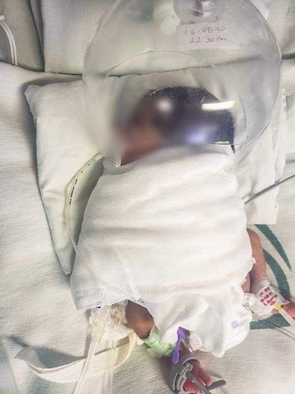 Nacieron cuatrillizos en HGZ 8 del IMSS Córdoba en medio de la emergencia