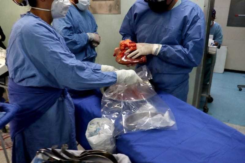 Realiza hospital del IMSS en Orizaba tercera procuración multiorgánica de 2021
