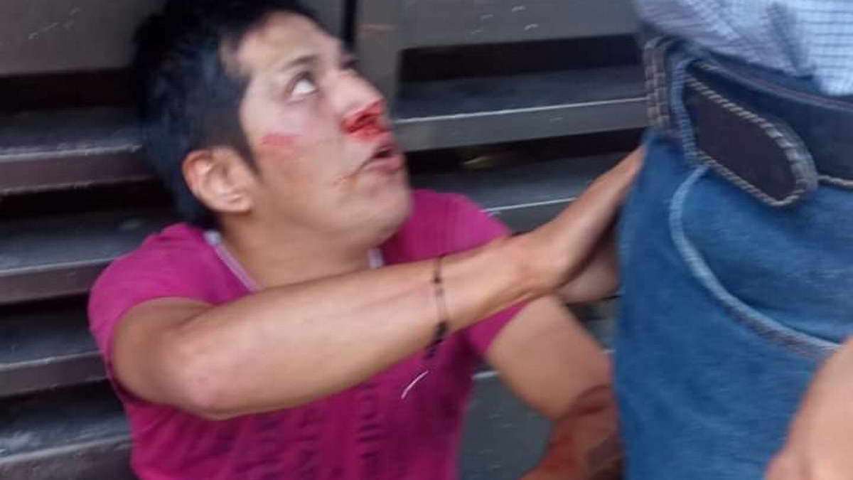 Tras sobrevivir a ejecución fallece “El Monky” en hospital “Yanga”