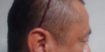 Asaltan A Taxista Y Lo Dejan Herido