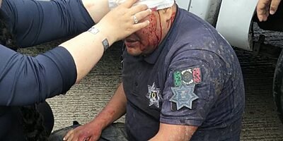 Patrulla de La Perla sin frenos choca contra muro; 2 policías graves