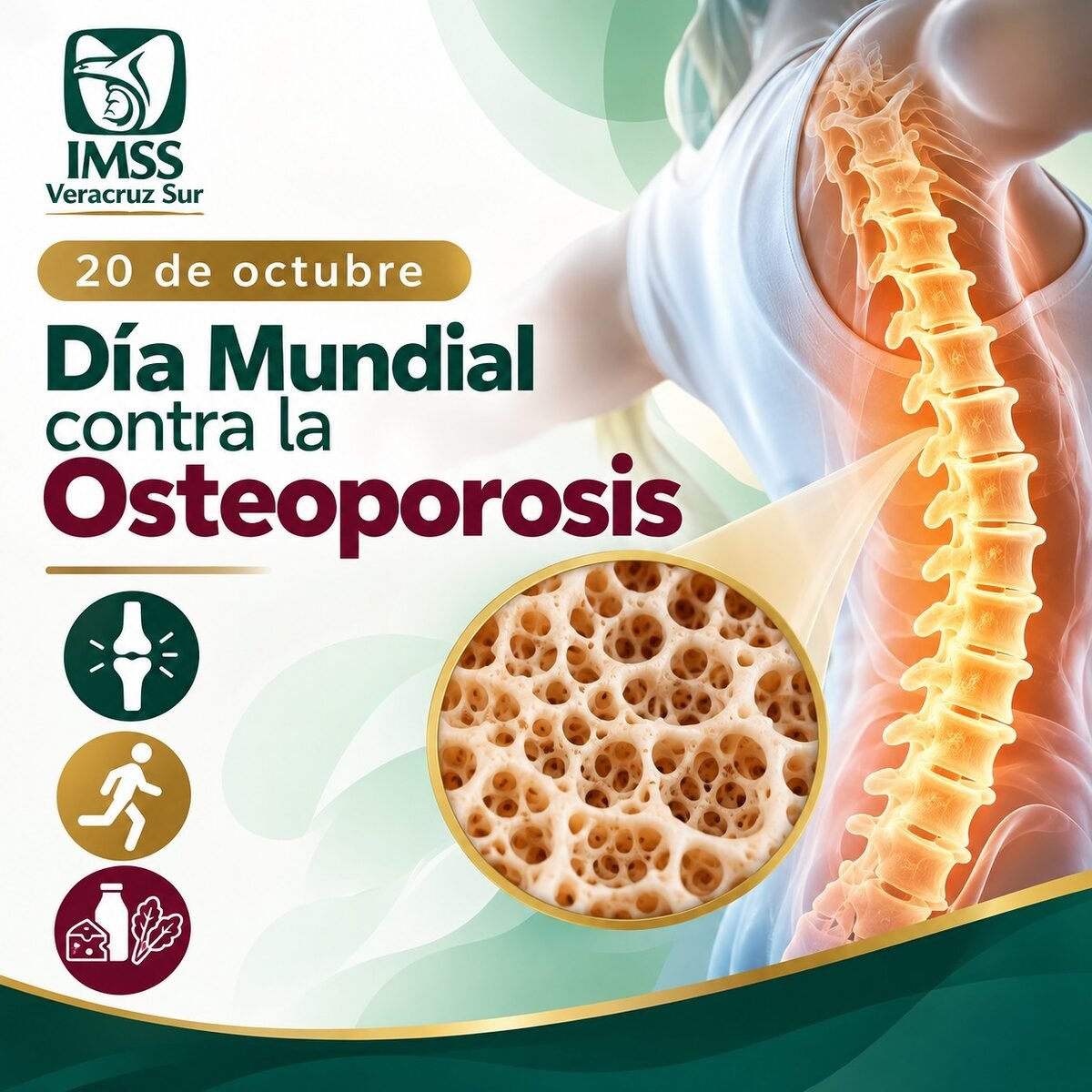 osteoporosis-imss-veracruz-sur
